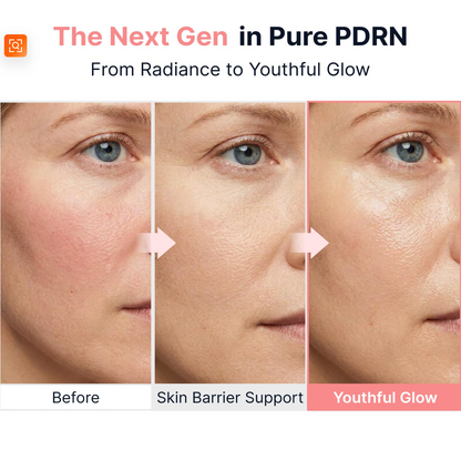 Zyrin AuraCell | PDRN Pink Vitamin Ampoule